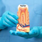 Tooth cross section model showing nerves dentist explaining sensitivity after crown