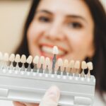 Dentist matching veneer shade for a natural looking smile in Houston