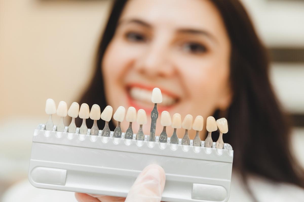 Dentist matching veneer shade for a natural looking smile in Houston