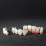 Dental crowns and bridge restoration placed on dark surface in Houston TX