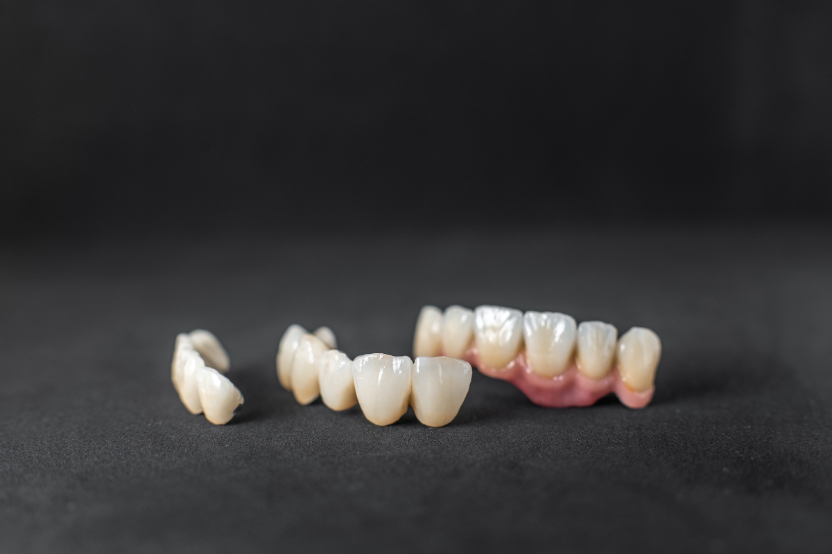 Dental crowns and bridge restoration placed on dark surface in Houston TX